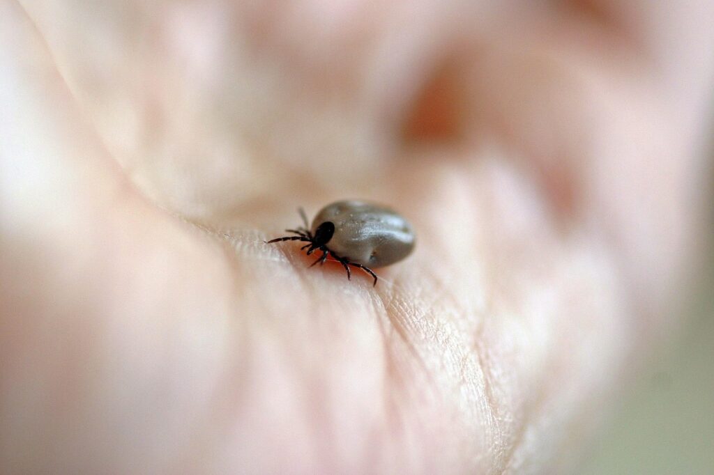 Engorged tick on a human hand.